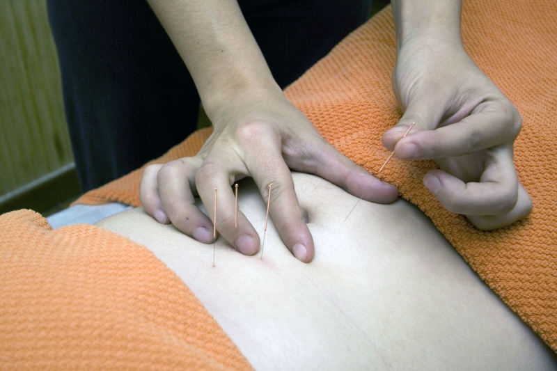 osteopathe-LUCERAM-min_acupuncture-4175625